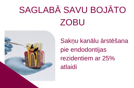 Sakņu kanālu ārstēšana ar 25% atlaidi pie endodontijas rezidentiem